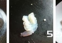 杏仁虾球的做法