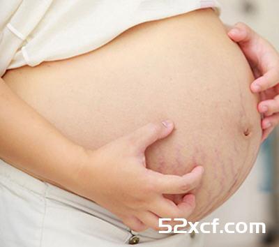 月子里怎么去妊娠纹？月子里吃什么可以去妊娠纹？