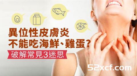 异位性皮肤炎不能吃海鲜、鸡蛋常见问题解答